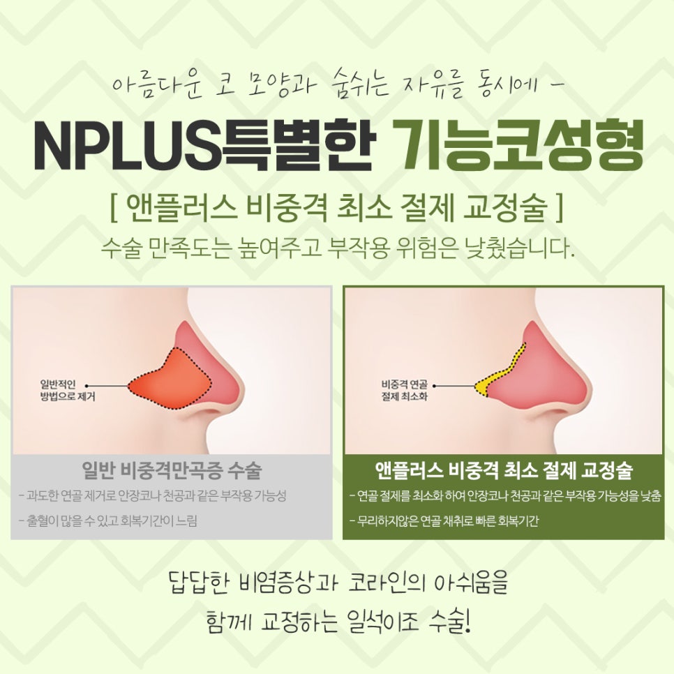 Rhinoplasty for Rhinitis at a Good ENT Clinic image 10