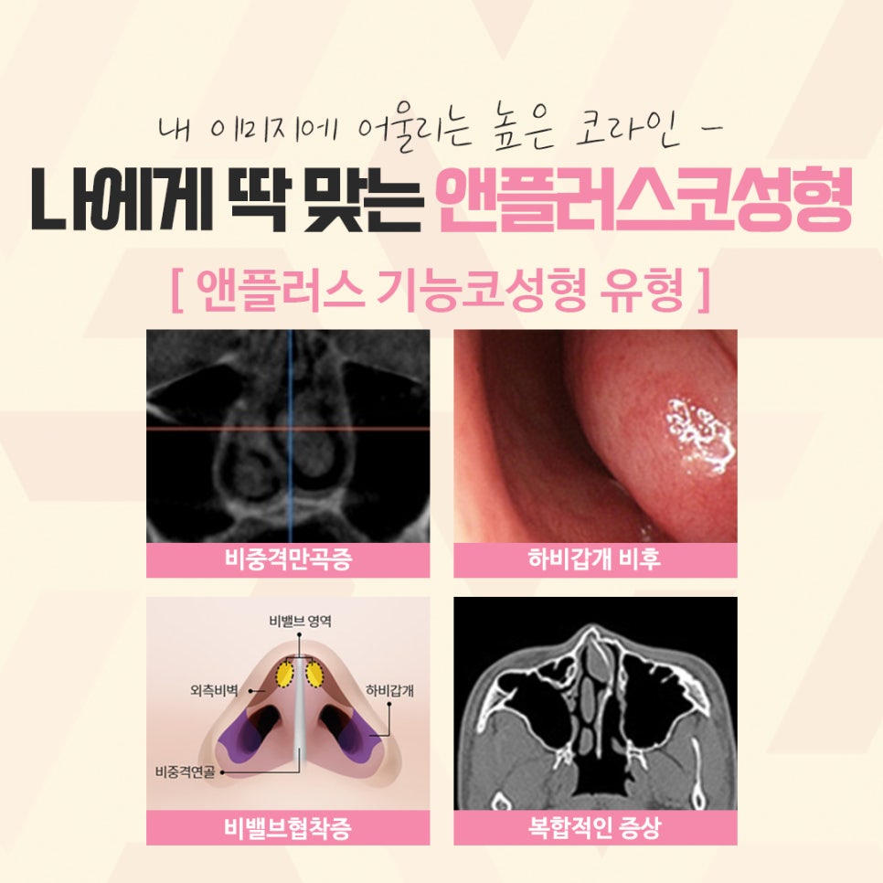 What to Carefully Consider Before and After Rhinoplasty image 5