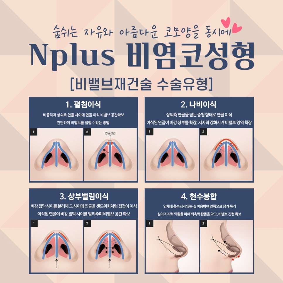 비염수술 정확한 진단으로 관련 이미지 6