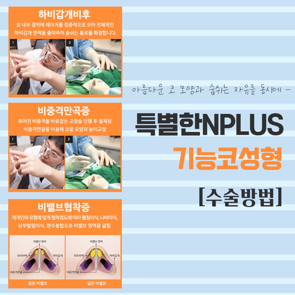 기능코수술실비 확실하게 알아보고 관련 이미지 8