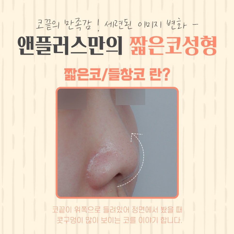 짧은코수술에 대한 정보를 찾는다면 관련 이미지 5