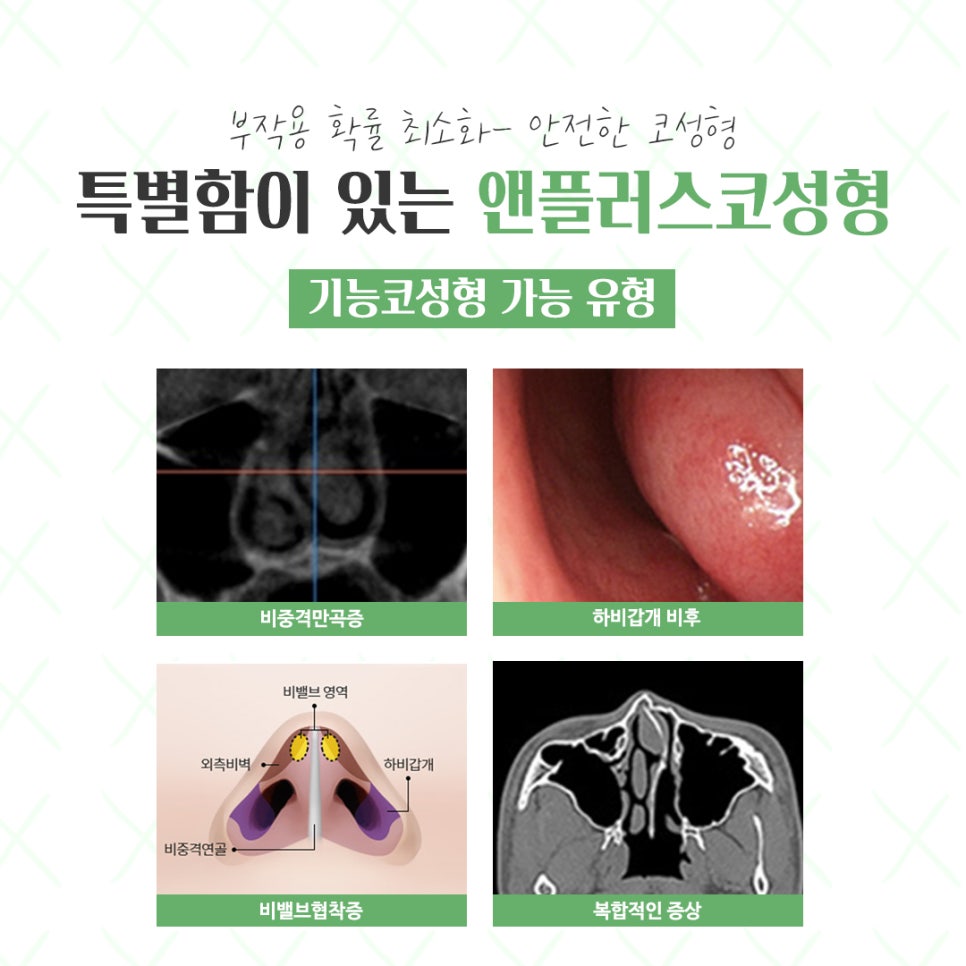 Check Rhinoplasty Reviews for a Natural and Beautiful Result image 5