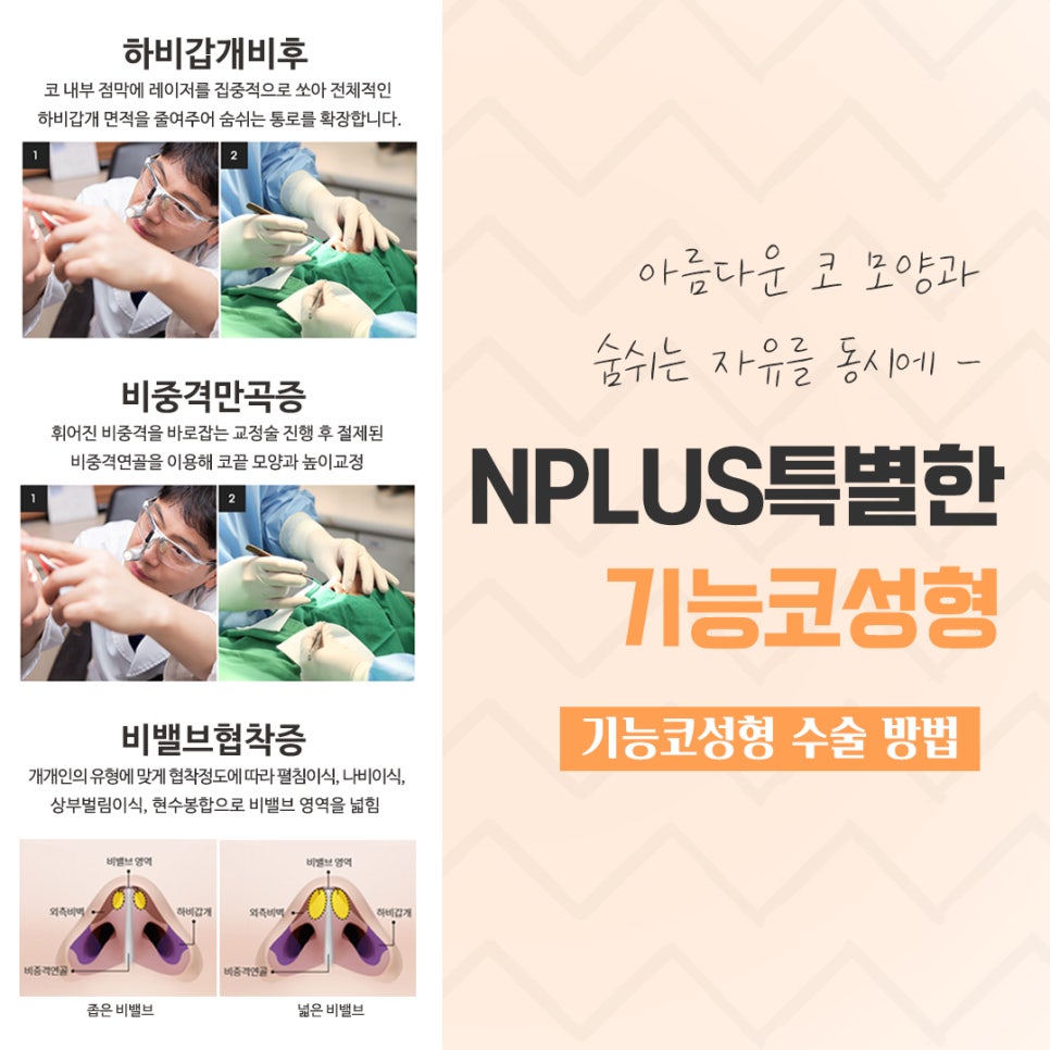 기능코수술후기 자세하게 알아봐야 관련 이미지 9