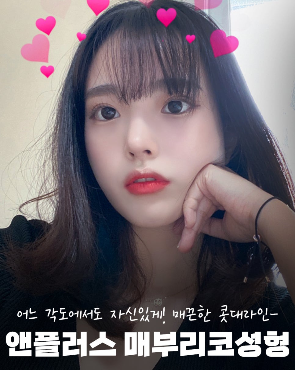 매부리코수술후기_완벽한 매부리제거로 깔끔하게 관련 이미지 1