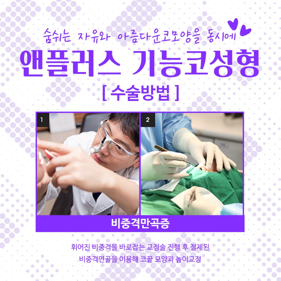 Nose Surgery Review from Anplus Plastic Surgery image 9