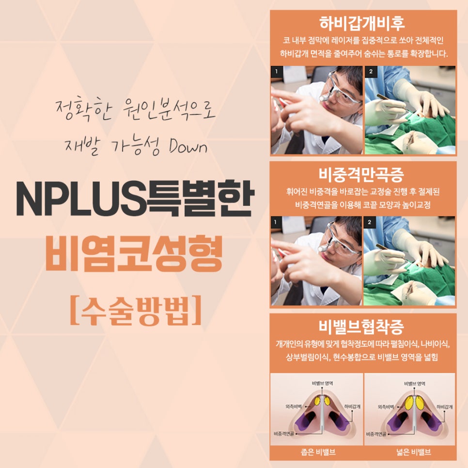 A Satisfying Result with One Rhinoplasty and Rhinitis Surgery image 9