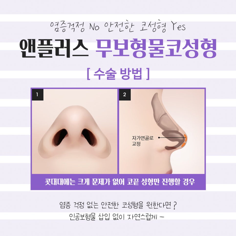 무보형물코성형후기 만족스러운 라인으로 관련 이미지 10