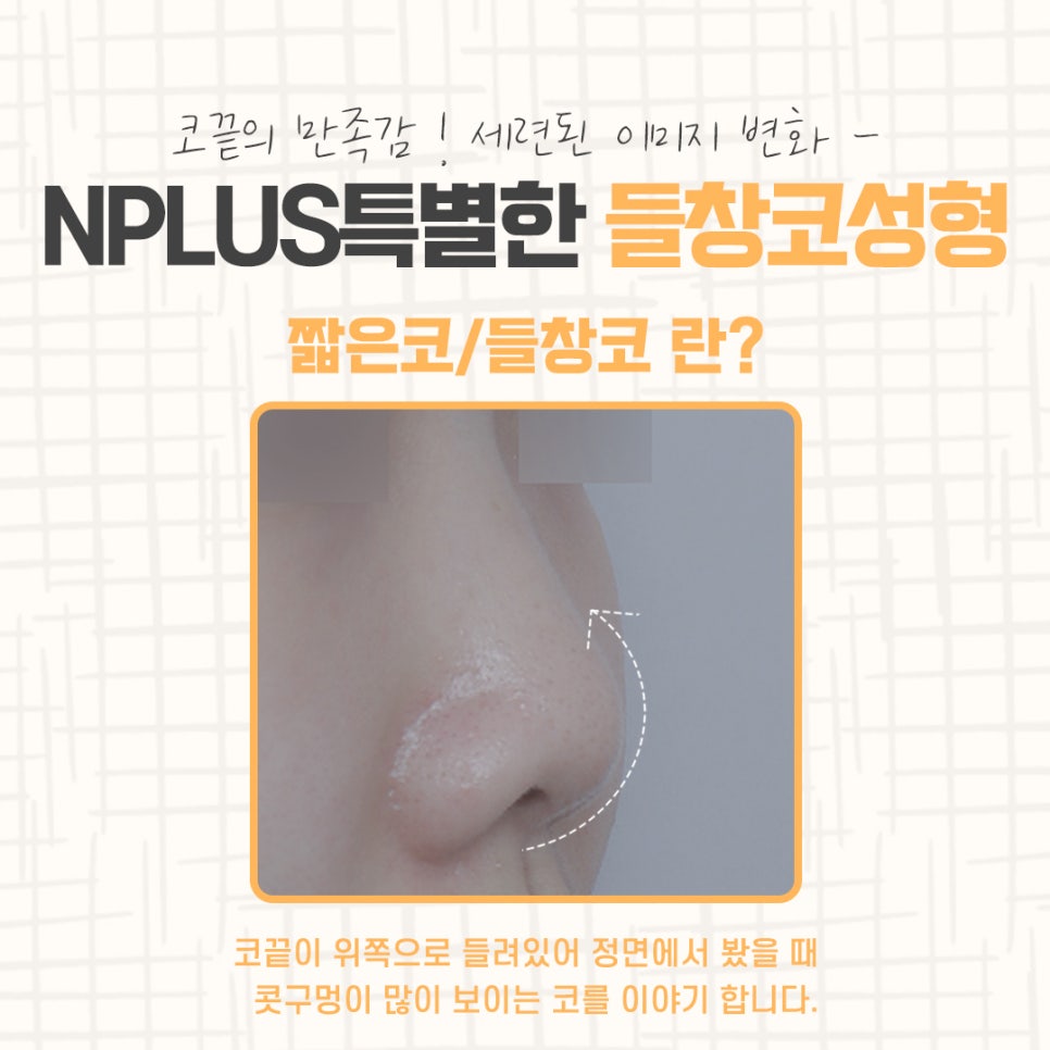 Delicate Upturned Nose Surgery image 3