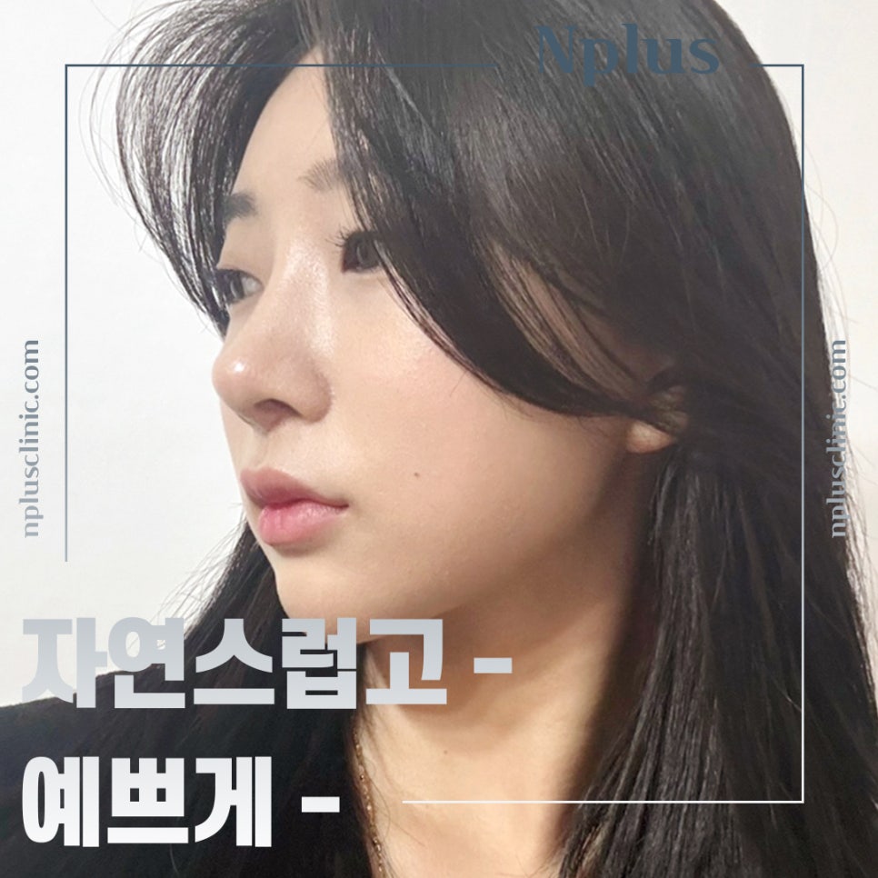 If You Are Looking in Detail at Functional Nose Surgery Before and After image 13
