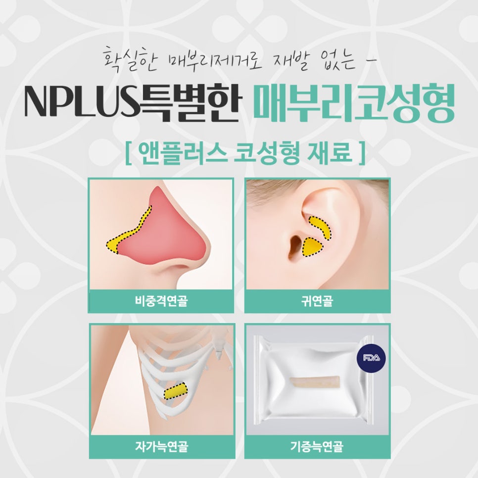 매부리코성형후기 부드러운 인상으로 관련 이미지 13
