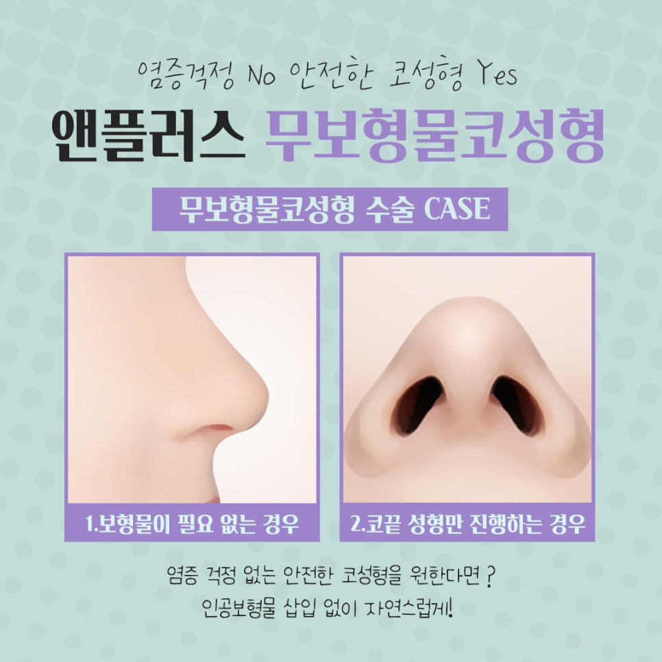 Safety First: Check Reviews of Non-Implant Rhinoplasty image 10