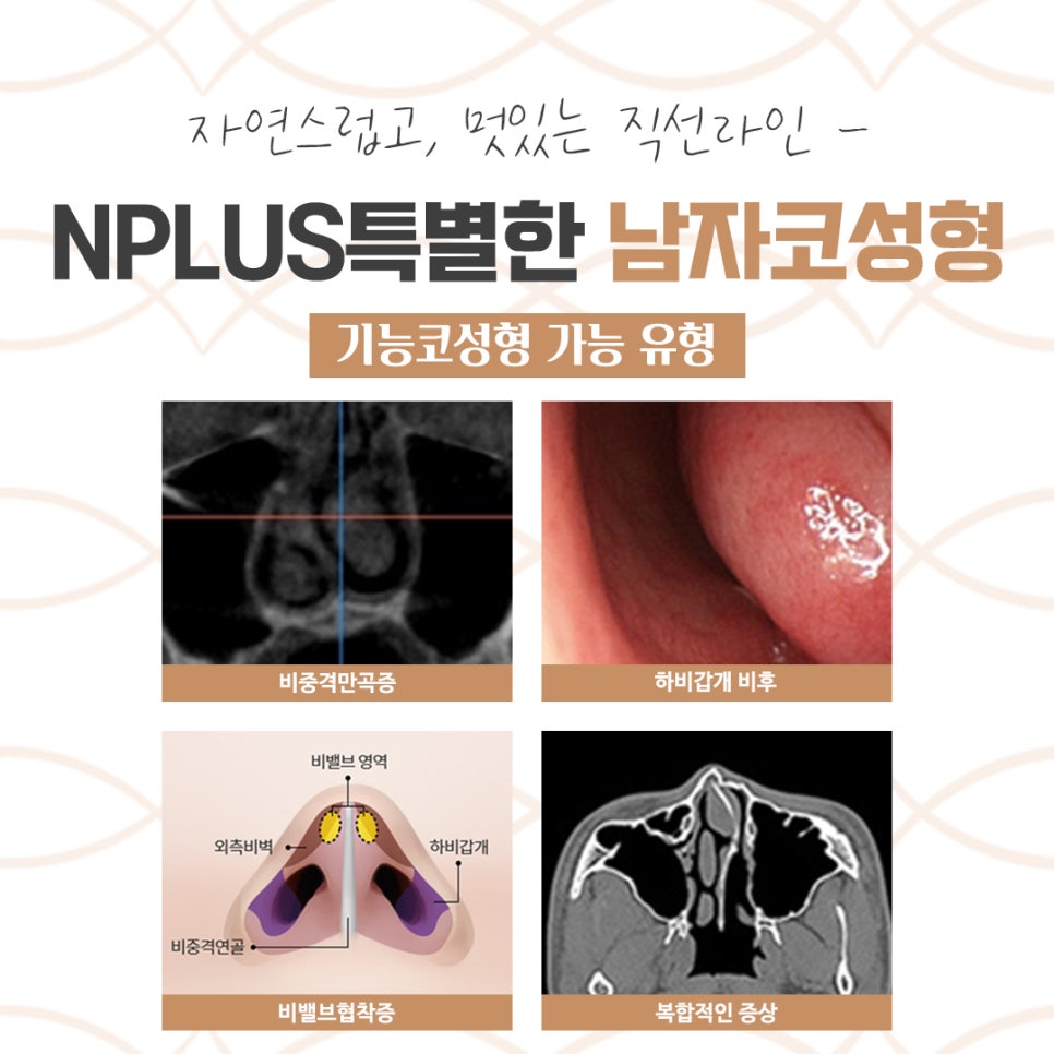 남자코성형전후 확인하고 개선 관련 이미지 12