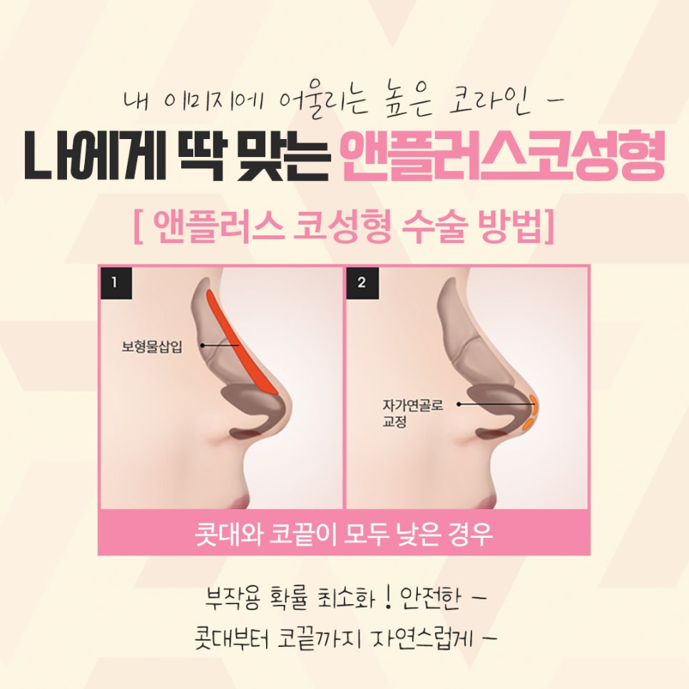 What to Carefully Consider Before and After Rhinoplasty image 8