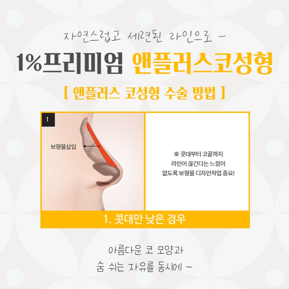 자가늑연골코성형의 필요성 관련 이미지 8