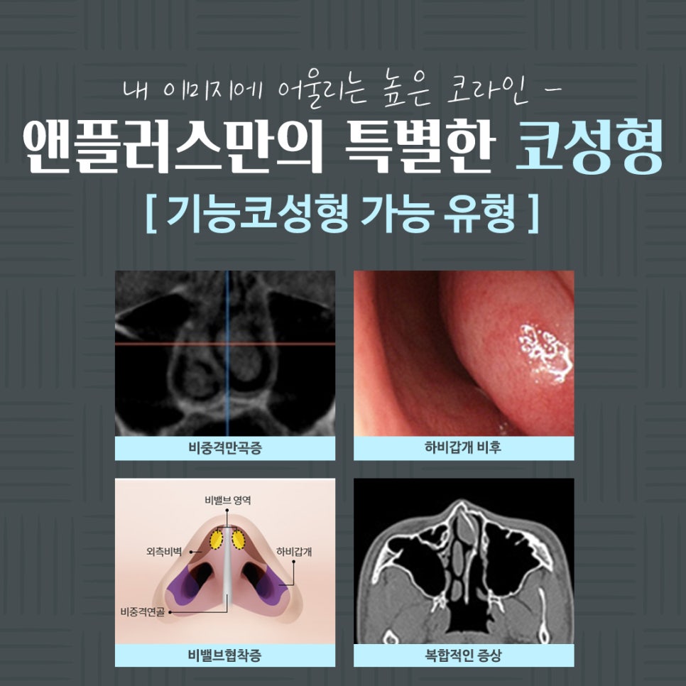 코수술전후 확실한 차이 관련 이미지 5