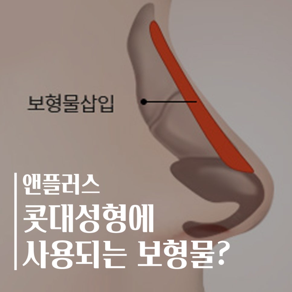 Everything About the Implants Used in Nasal Bridge Surgery image 1