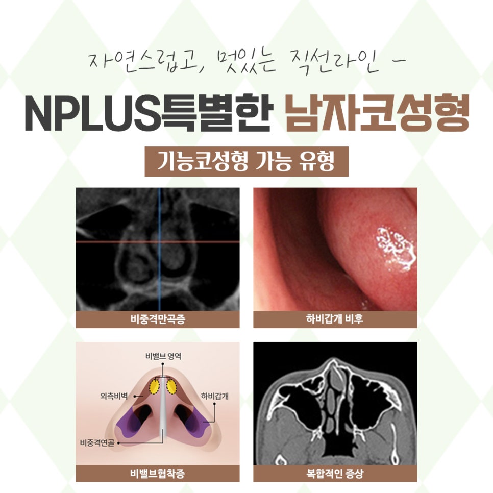 남자코성형후기를 확인하고 이미지 개선 관련 이미지 6