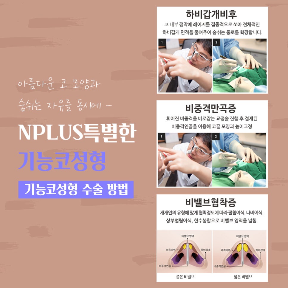 기능코수술후기 정확하게 알아보고 관련 이미지 10