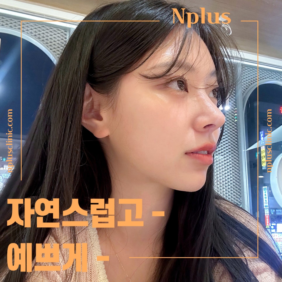 코수술후기에 대해 자세하게 알아보고 관련 이미지 1