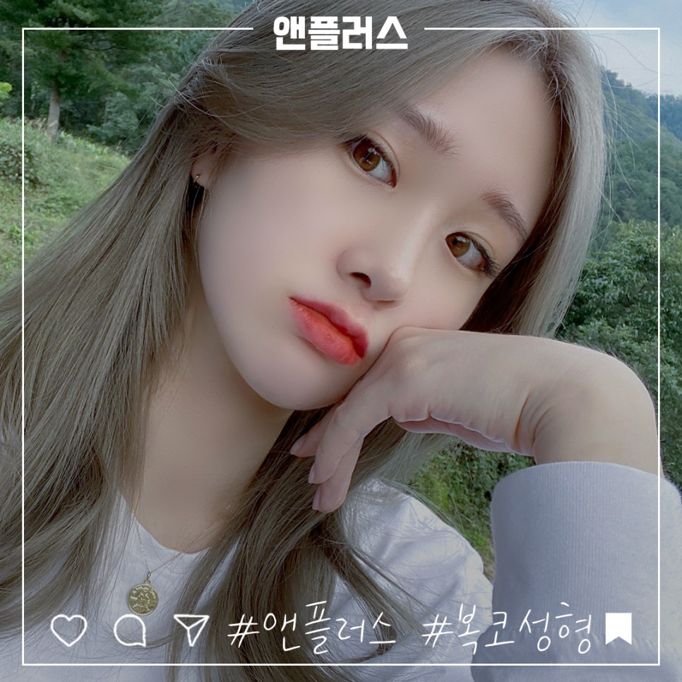 복코수술후기 세련된 인상으로 관련 이미지 2