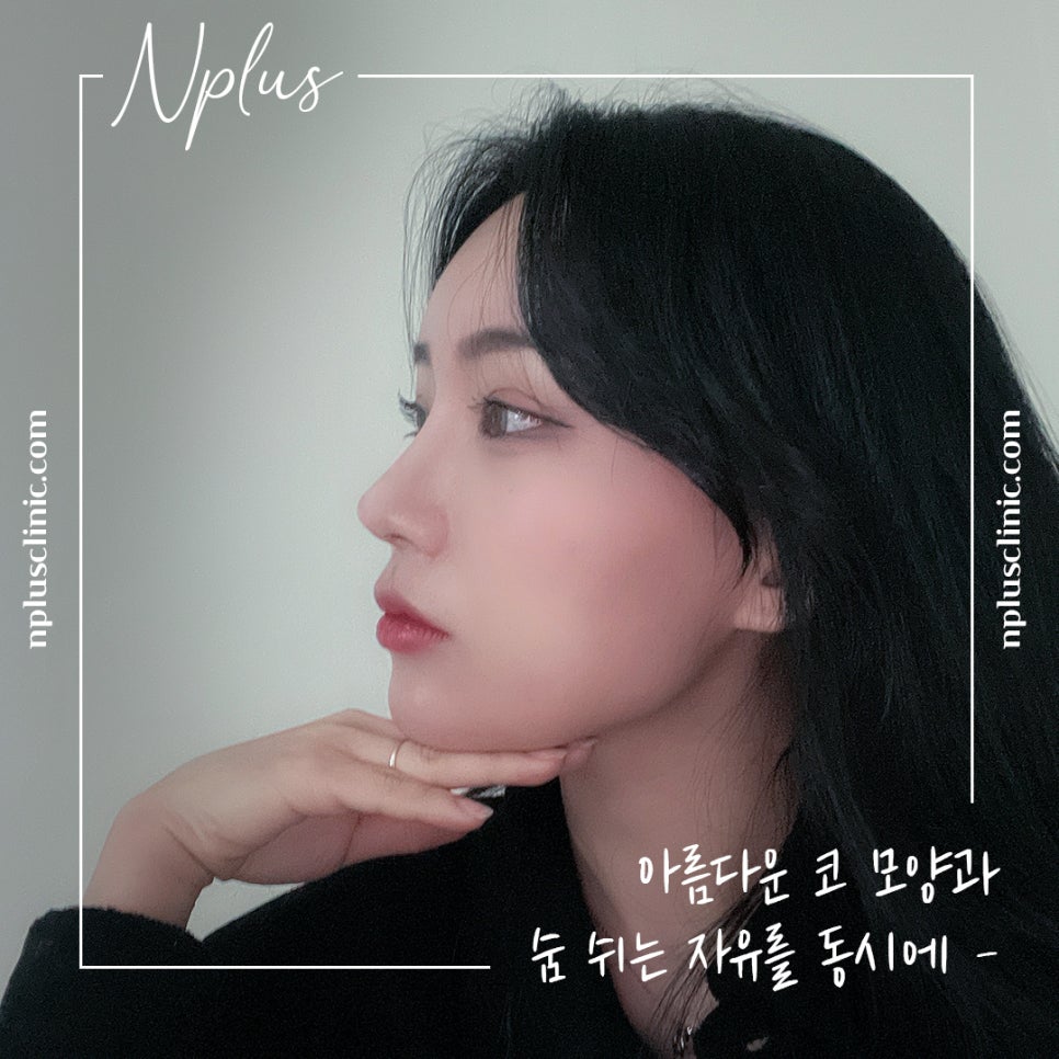자가늑연골코수술 기능까지 생각해서 관련 이미지 2