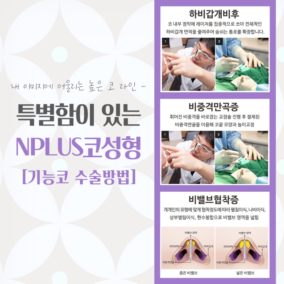 코수술잘하는곳 자세하게 알아보고 관련 이미지 11