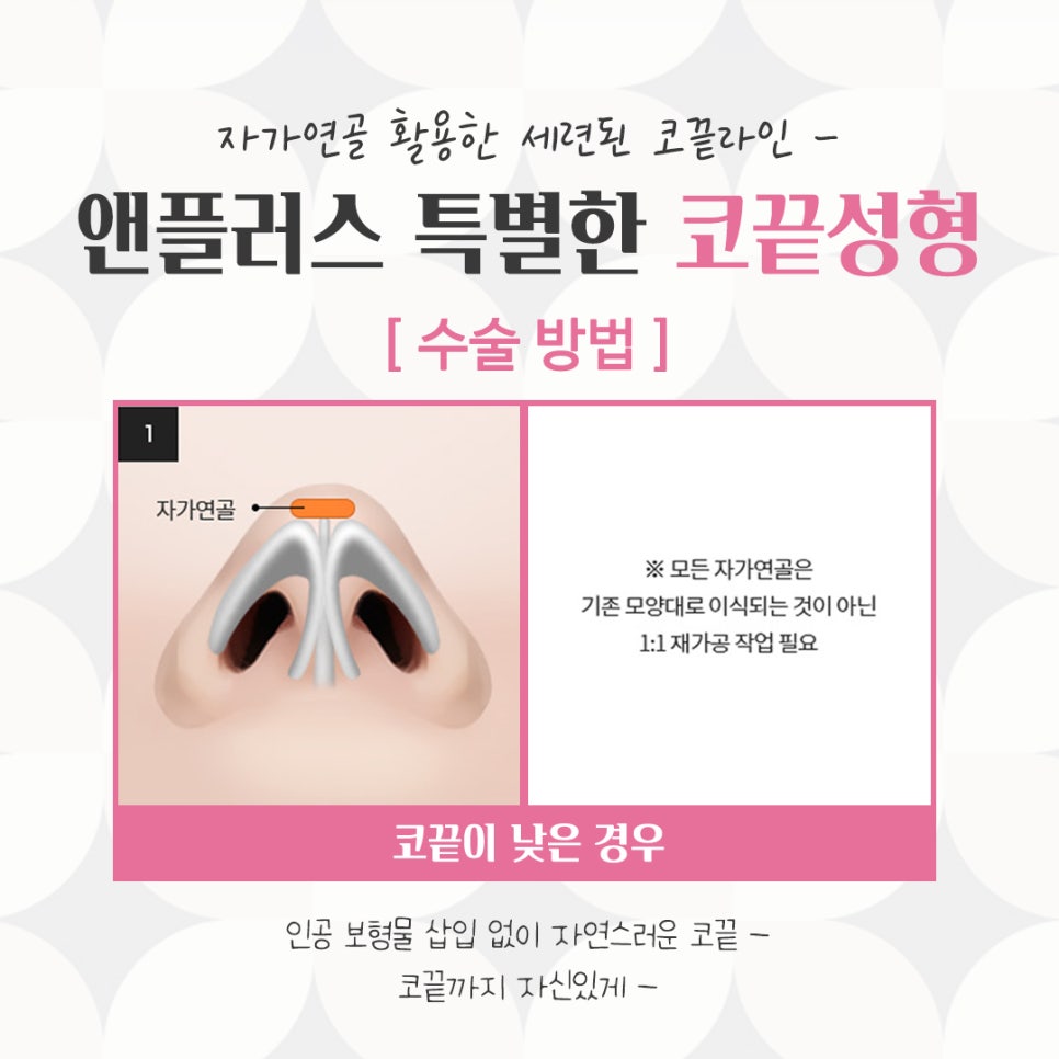 코끝수술후기의 다양함을 알아보고 관련 이미지 7