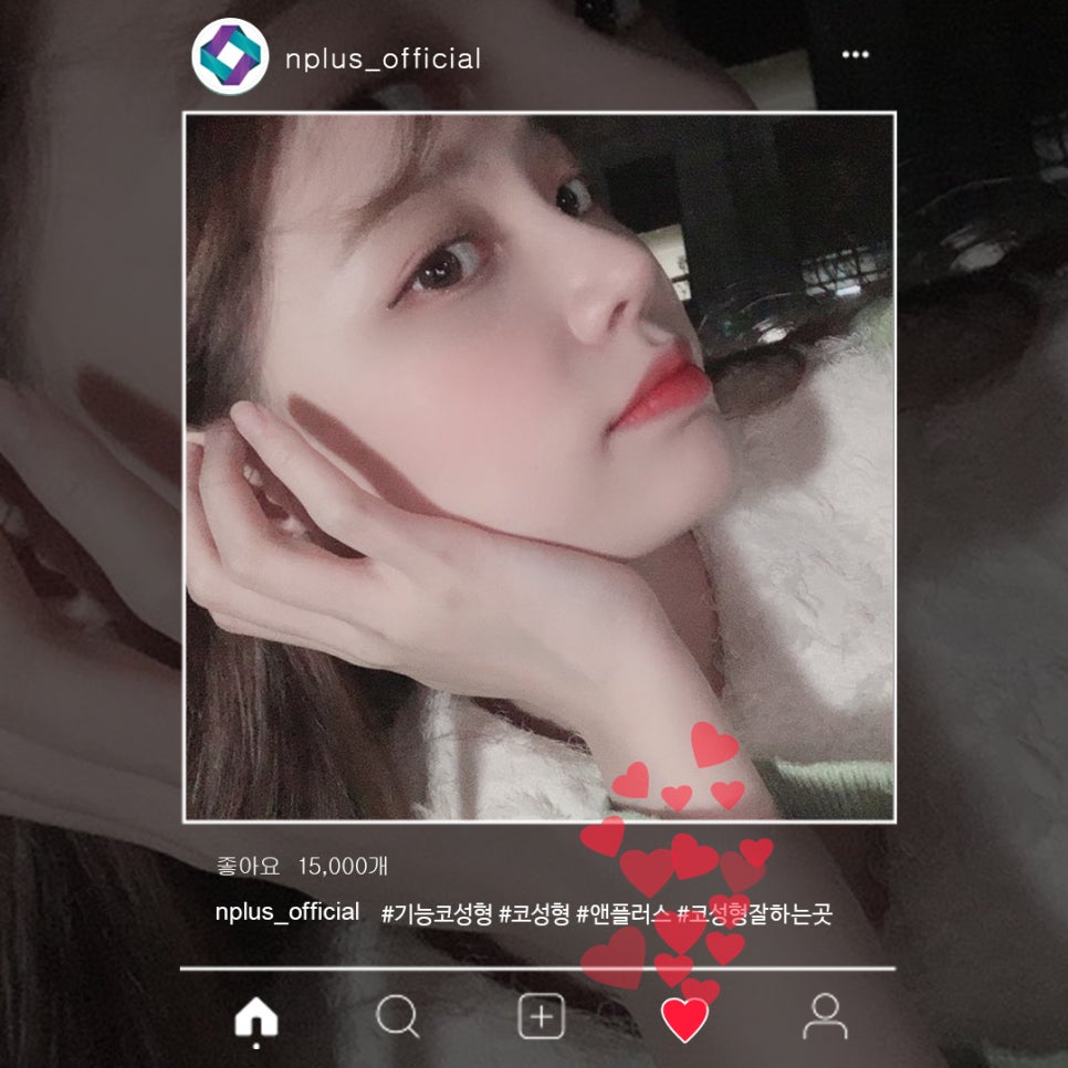 콧볼축소후기 확실하게 알아보고 관련 이미지 2