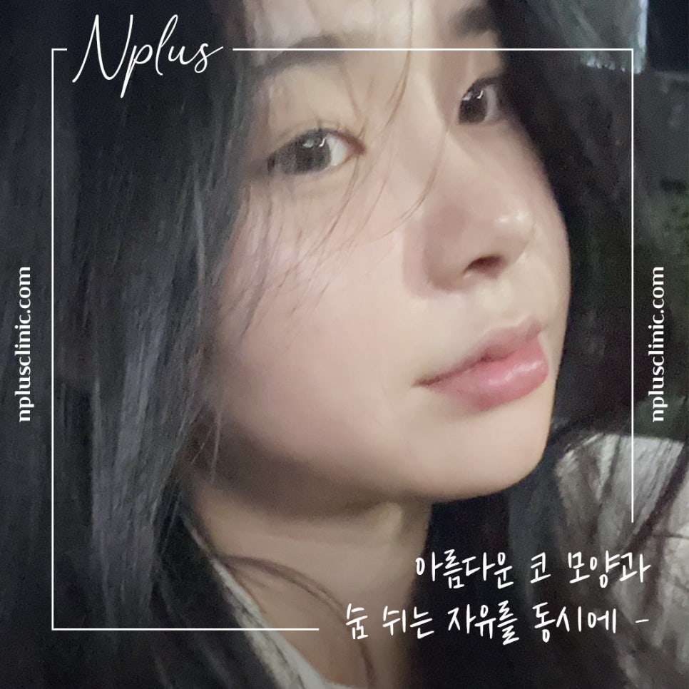 자가늑코수술 내게 어울리는 라인으로 관련 이미지 3