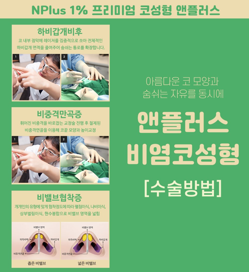 비염수술코성형 동시에 개선이 가능 관련 이미지 8