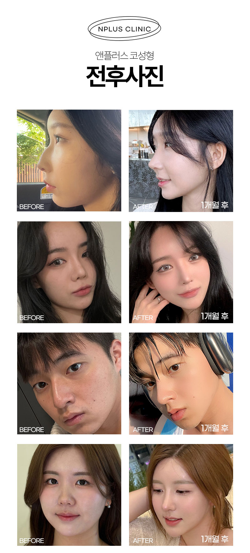 🙌앤플러스의원 코성형 2024수험생이벤트🙌 관련 이미지 4