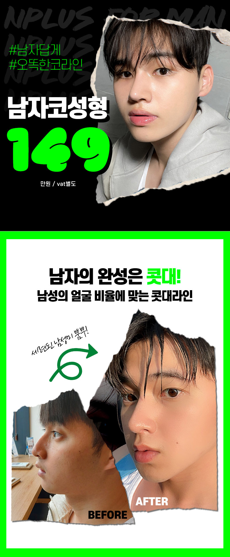 앤플러스의원 남자코성형 이벤트 관련 이미지 2