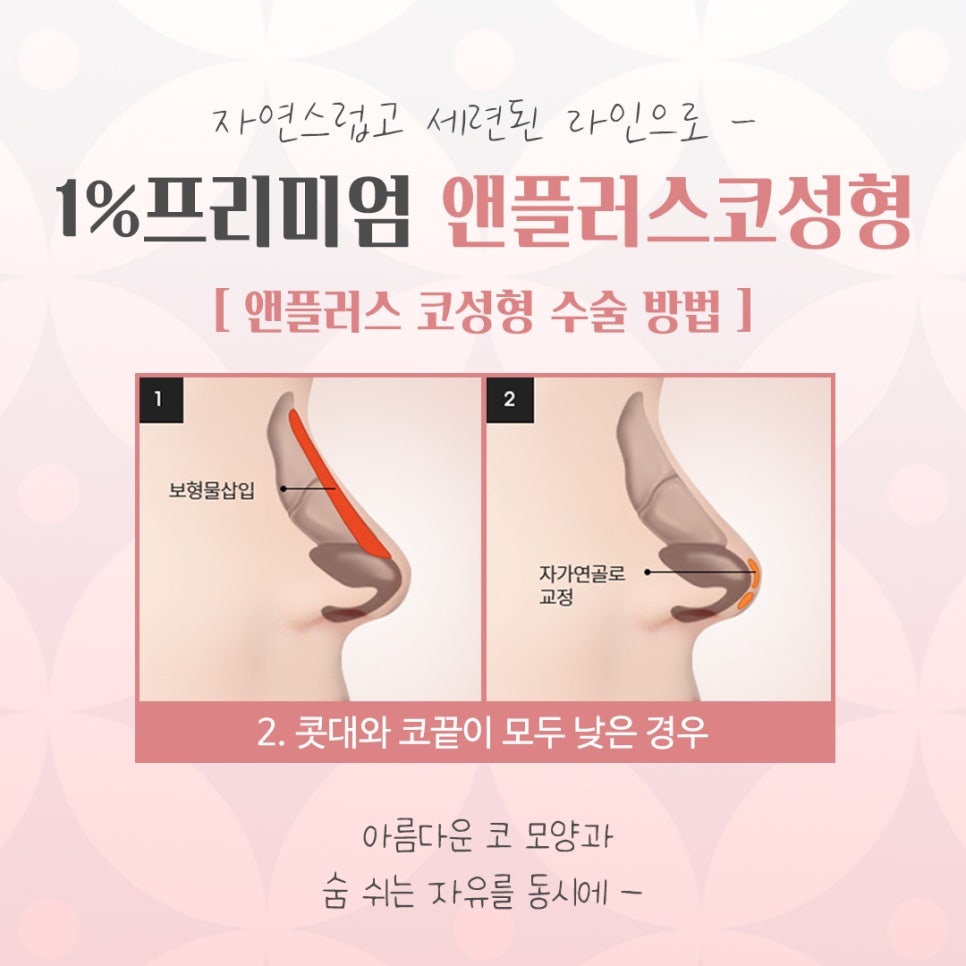 If You Want to Learn About Autologous Rib Cartilage Nose Surgery Accurately image 9
