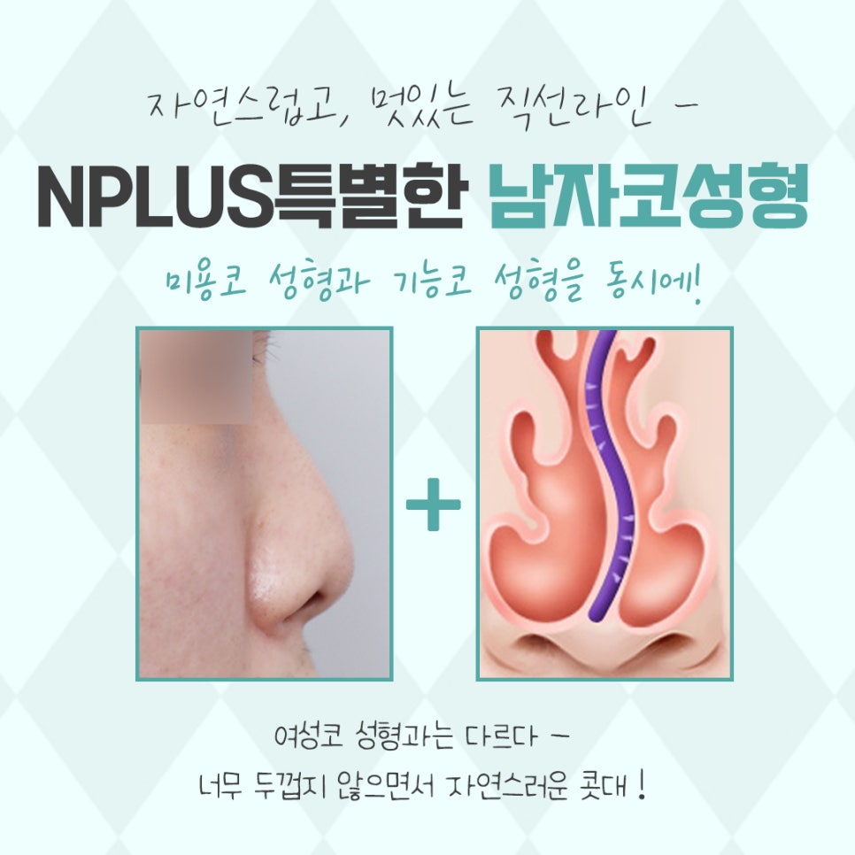 Looking into Male Rhinoplasty, Including Function image 4