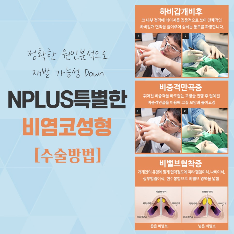 비염수술코성형 한 번의 선택으로 관련 이미지 9