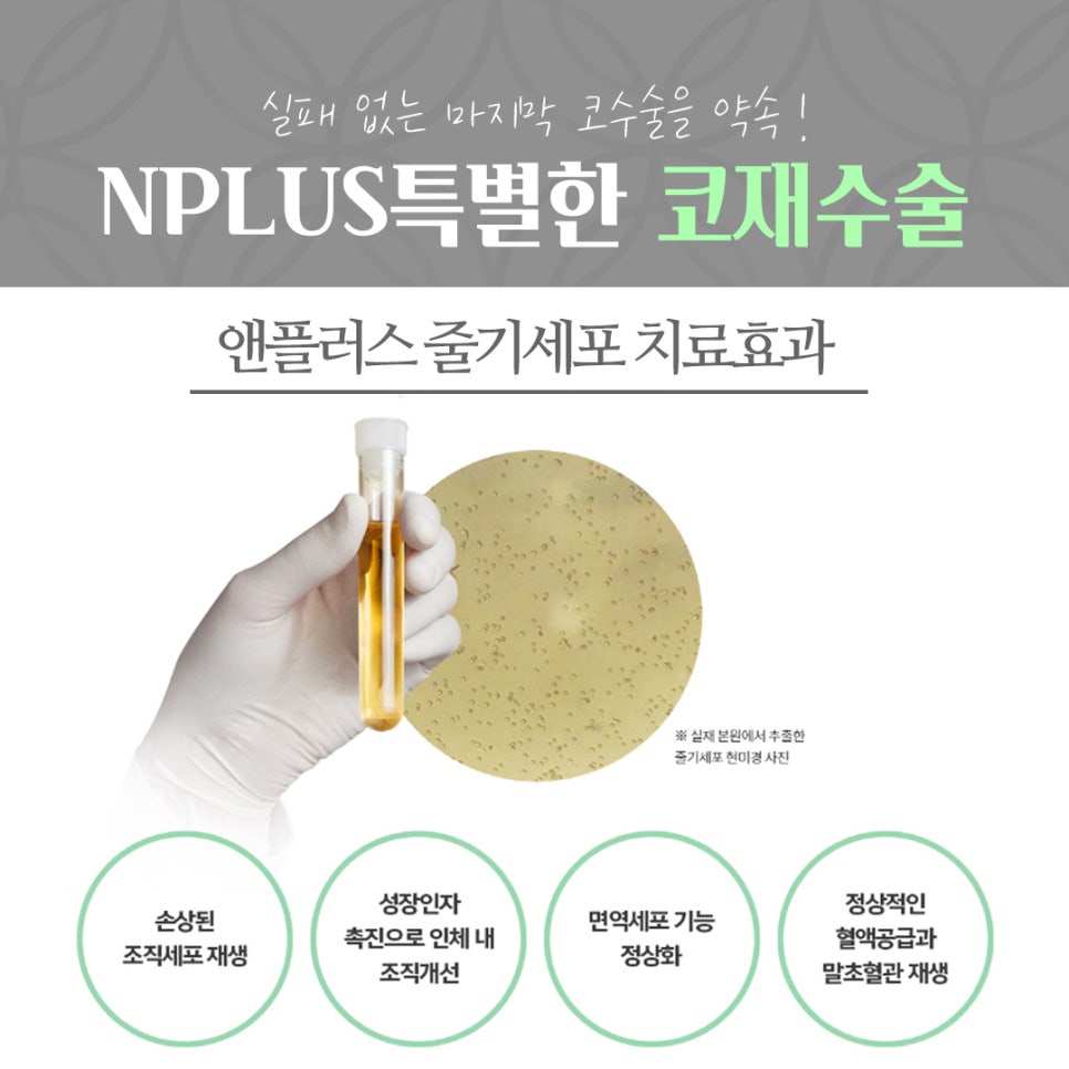 코재수술후기 확실하게 진단하여 관련 이미지 11