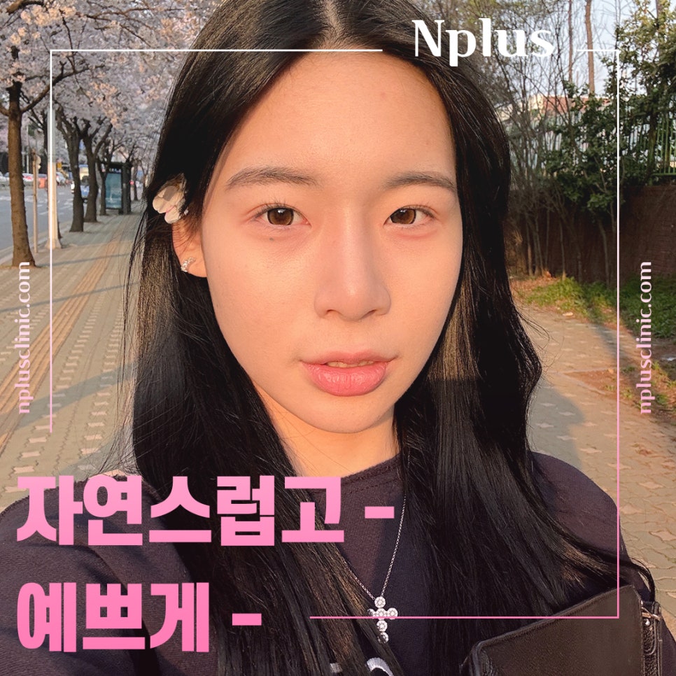 매부리코수술전후 비교를 한다면 관련 이미지 5