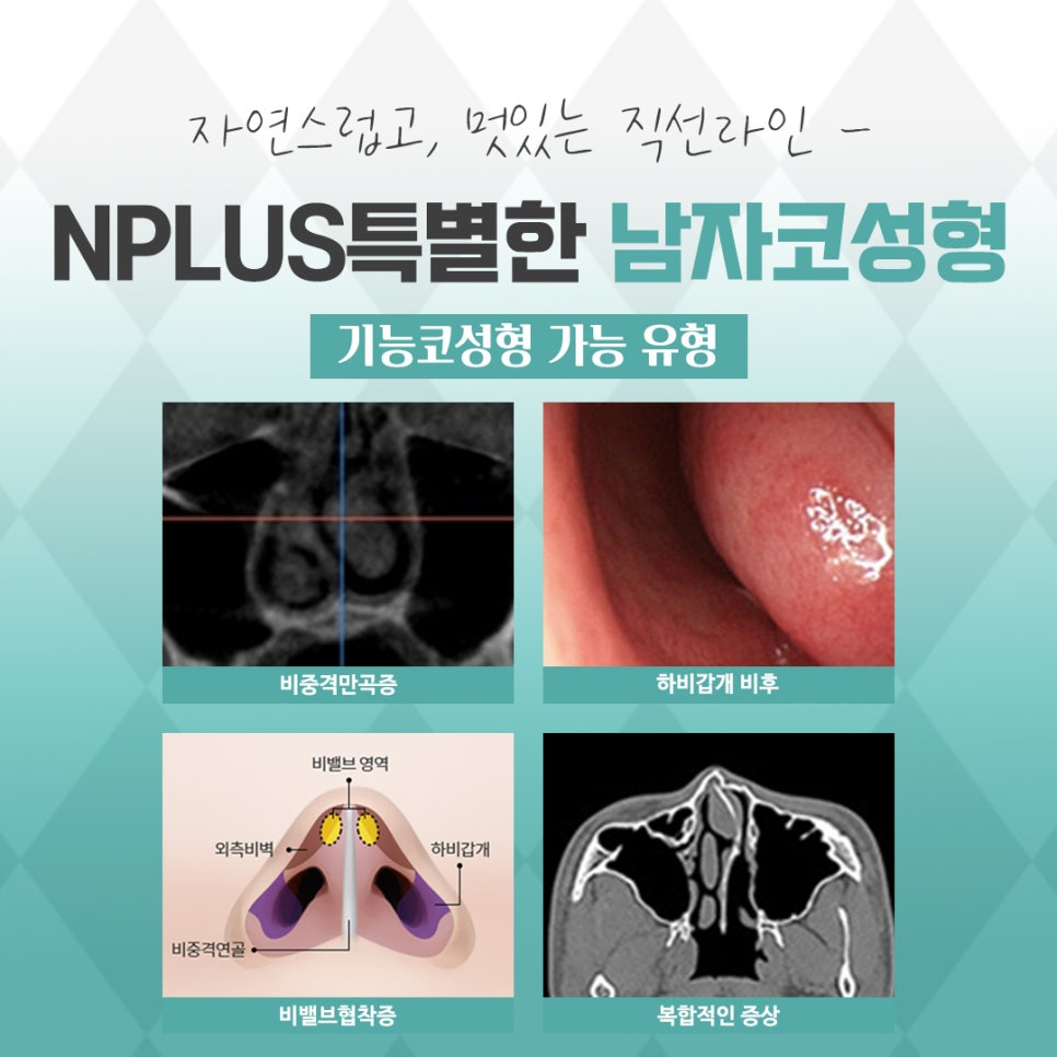 남자코성형후기 기능에 대해 알아보고 관련 이미지 11