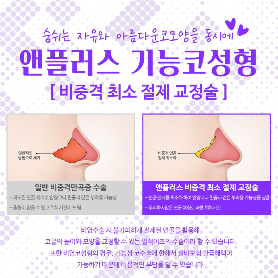 Nose Surgery Review from Anplus Plastic Surgery image 7
