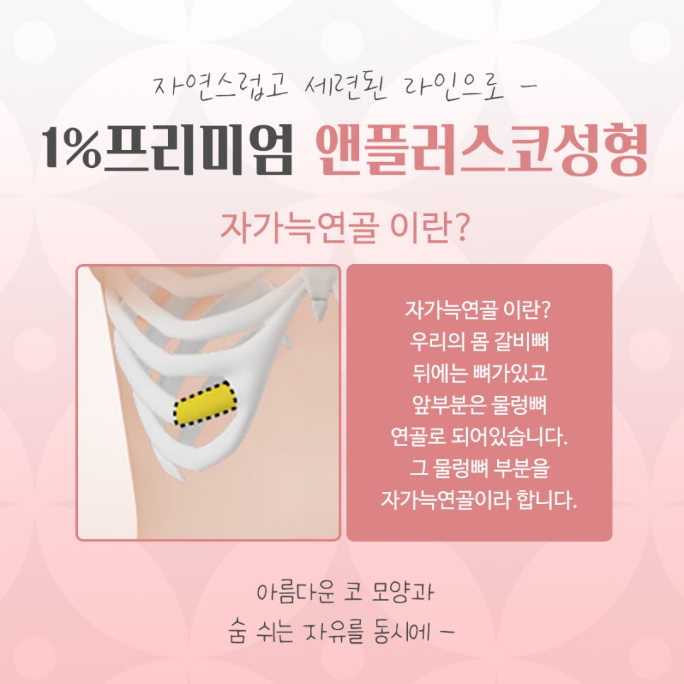 늑연골코수술을 통해 세련된 라인으로 관련 이미지 5