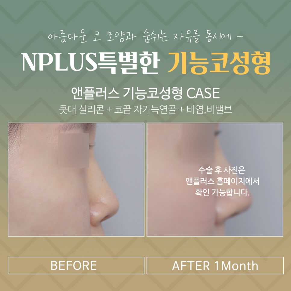 Making an Accurate Judgment About Functional Rhinoplasty Reviews image 13