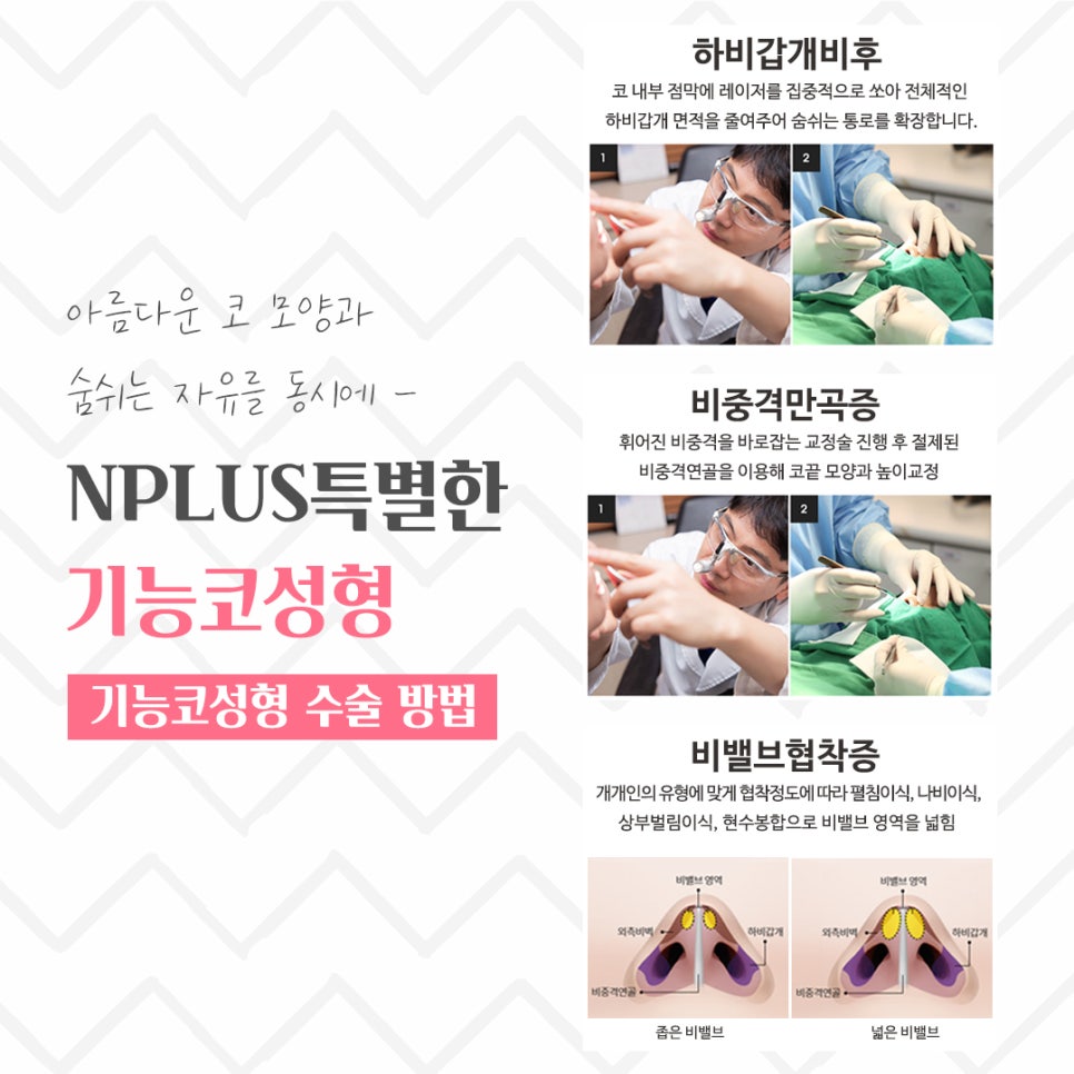 기능코성형후기 원인 파악을 확실하게 관련 이미지 9
