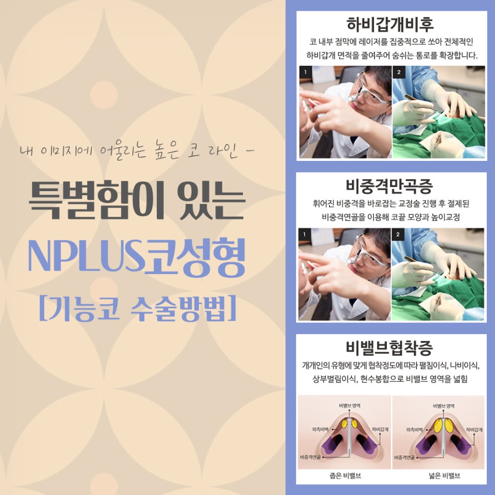 코성형후기 내부 기능까지 확실하게 관련 이미지 11