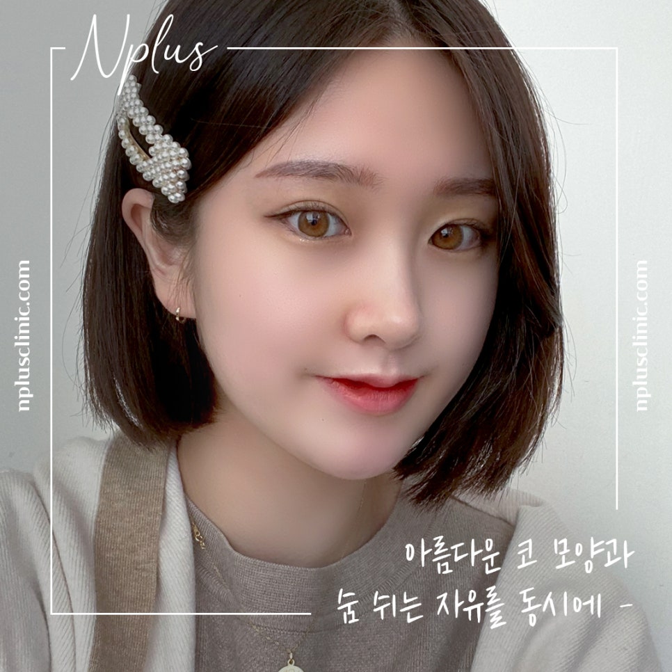 늑연골 코수술 자세하게 알아보고 관련 이미지 14