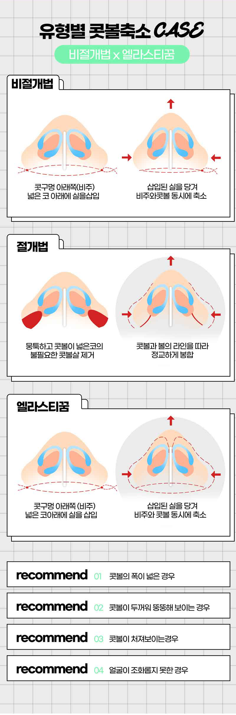 Looking into Nose Flare Reduction Reviews image 6