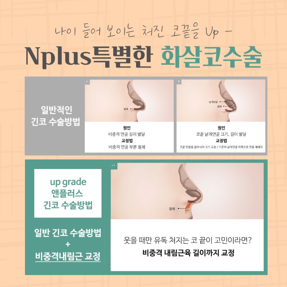 화살코수술 후기까지 알아보고 결정 관련 이미지 11