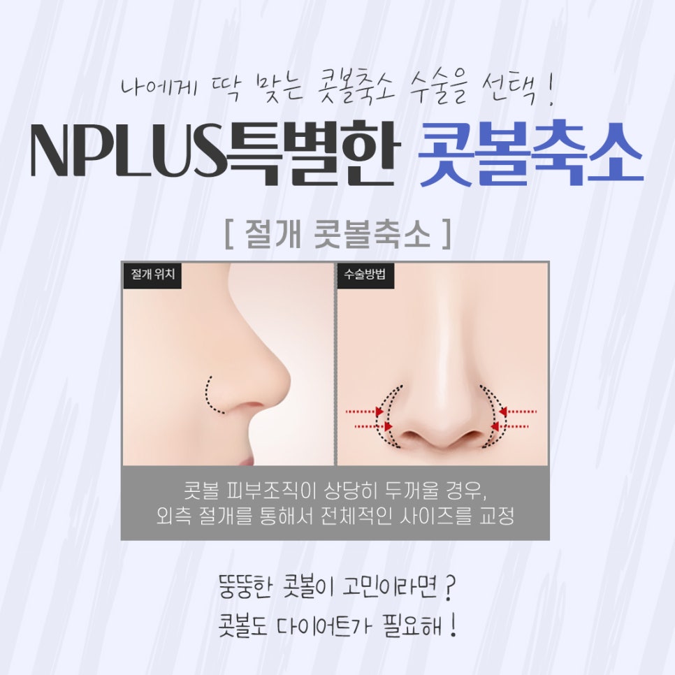 The Importance of Choosing a Nostril Reduction Review image 9