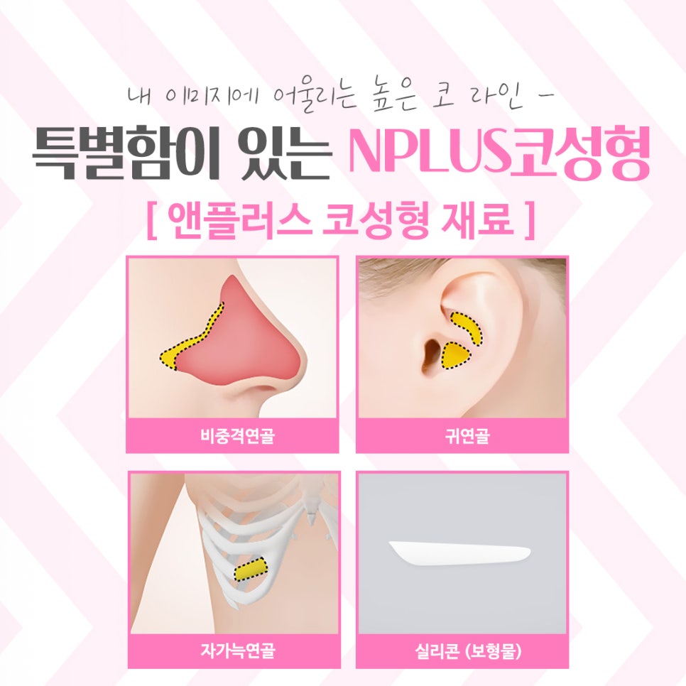 코성형잘하는곳 여러 가지를 고려하여 관련 이미지 9