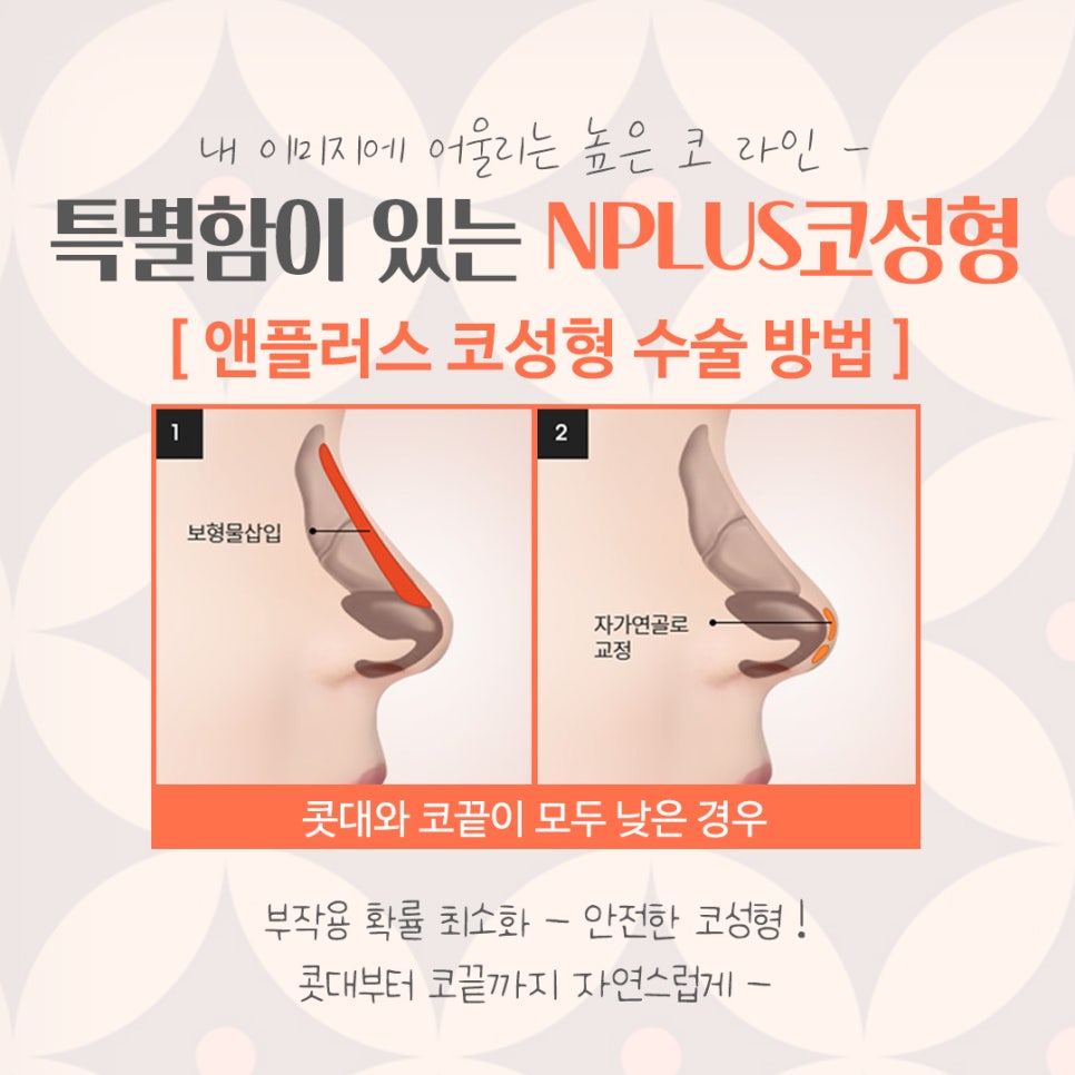 코성형잘하는병원의 차이를 알아보고 관련 이미지 7