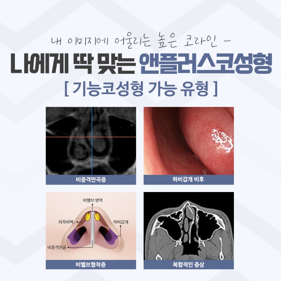 압구정코성형 자세하게 알아보고 관련 이미지 10